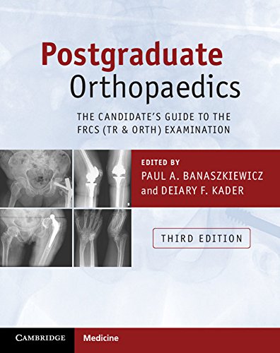 Postgraduate Orthopaedics: The Candidate's Guide to the FRCS (Tr & Orth) Examination (English Edition)