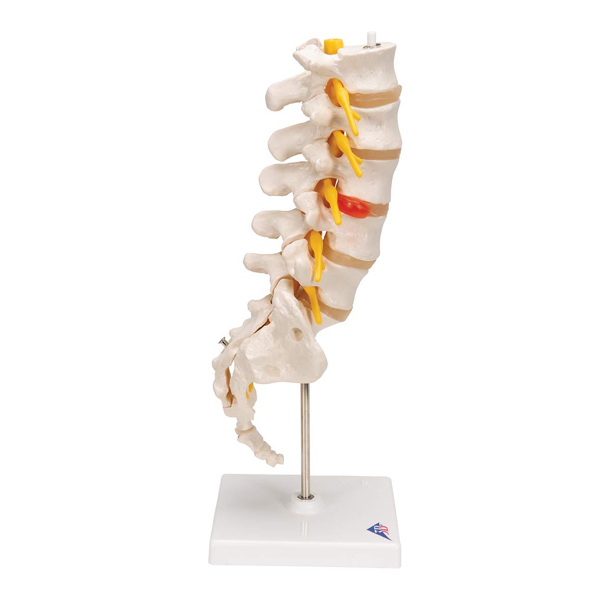 3B Scientific A76/5 Bel Omurga Sütunu, Dorso-Lateral Prolapsed Intervertebral Disk, 34 cm Yükseklik