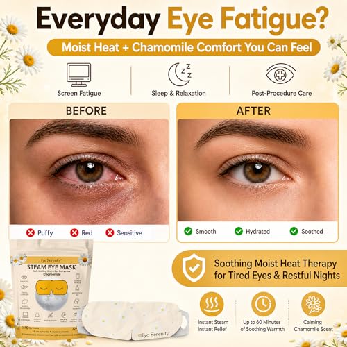 Image of Lure Essentials Steam Eye Mask, Heated Eye Mask, Self Heating Warm Compress for Dry Eyes, Fast Relief for Stye, Puffy Sensitive Eyes, Moist Heat, Relaxation Gifts for Women and Men - Chamomile