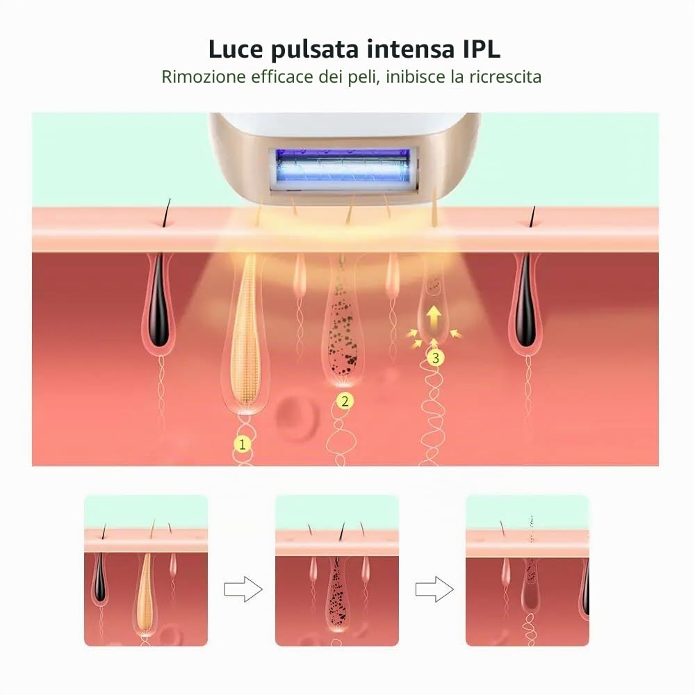 Epilatore laser depilazione per donna e uomo permanente laser ipl indolore,Luce Pulsata, Epilatore Laser per Donna,Uomo,Viso,Bikini,Corpo