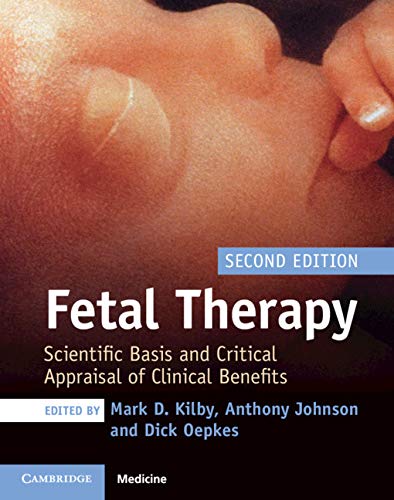 Fetal Therapy: Scientific Basis and Critical Appraisal of Clinical Benefits