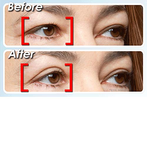 Eye Magic Premium Instant Eye Lift (Small/Medium) Made in America - Lifts and Defines Droopy, Sagging, Upper Eyelids - Thumbnail 2