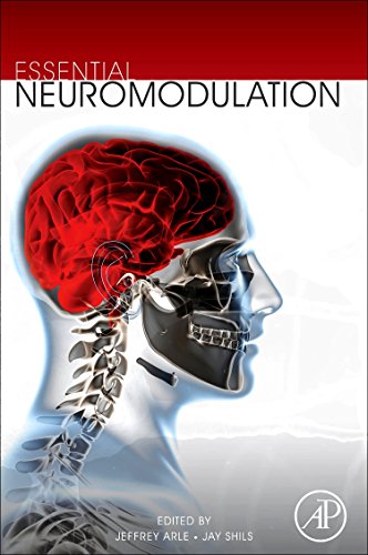 Essential Neuromodulation view 2