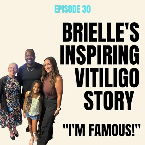 Brielle's Inspiring Vitiligo Story: "I'm Famous!"