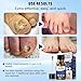 Toenail Fungus Treatment,Foot Fungus Treatment Extra Strength,Fungus Nail Treatment, Toe Nail Fungus Treatments For Fungi Nail yellow toenail treatment(1fl oz/30ml)