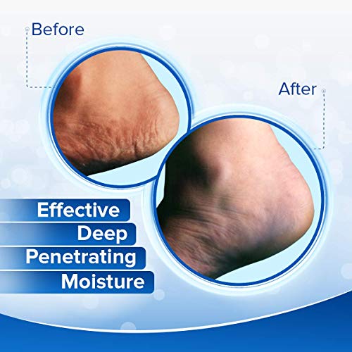 Dermal Therapy Heel Care Cream - Moisturizing Treatment that Repairs and Heals Dry, Rough, Cracked Heels and Feet | 25% Urea and 6% Alpha Hydroxy Acids (3 Ounce)