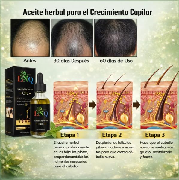Aceite Capilar Herbal LNQ – Fórmula Natural para Crecer, Fortalecer y Engrosar el Cabello