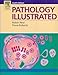 Pathology Illustrated