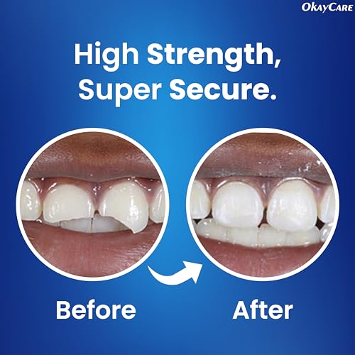 Zinc Oxide Eugenol Dental Cement Kit – Instant Tooth Repair, Cap, Crown & Bridge Filling | Ultra Strong & Pulp-Soothing Formula | Long Lasting - Easy Mix-and-Use Dental Adhesive for DIY, Home & Clinic - Thumbnail 4