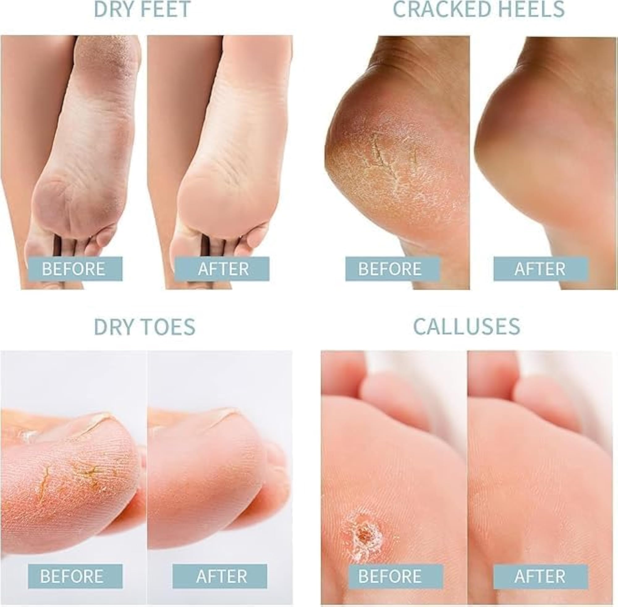 Coconut Oil Foot Peeling Mask