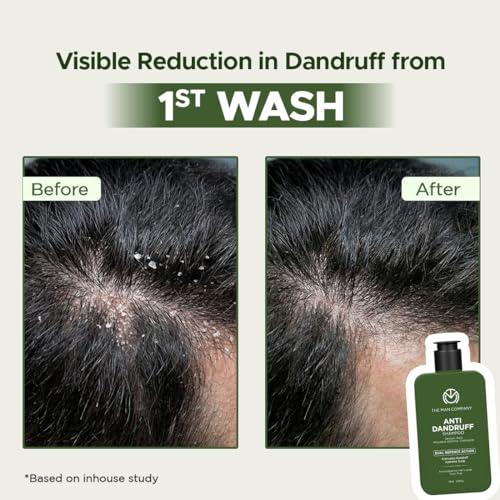 Image of The Man Company Anti-Dandruff Shampoo with Salicylic Acid for Man| Flake Control from First Wash | Targets Dandruff & Scalp Itch | Prevents Recurrence | Balances Oil Without Dryness | -100ml