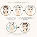 Anjou Blackhead Remover Comedone Extractor, Curved Blackhead Tweezers Kit, 6-in-1 Professional Stainless Pimple Acne Blemish Removal Tools Set