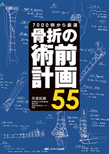 無料電子書籍 pdf 骨折の術前計画55: 7000例から厳選 バイ