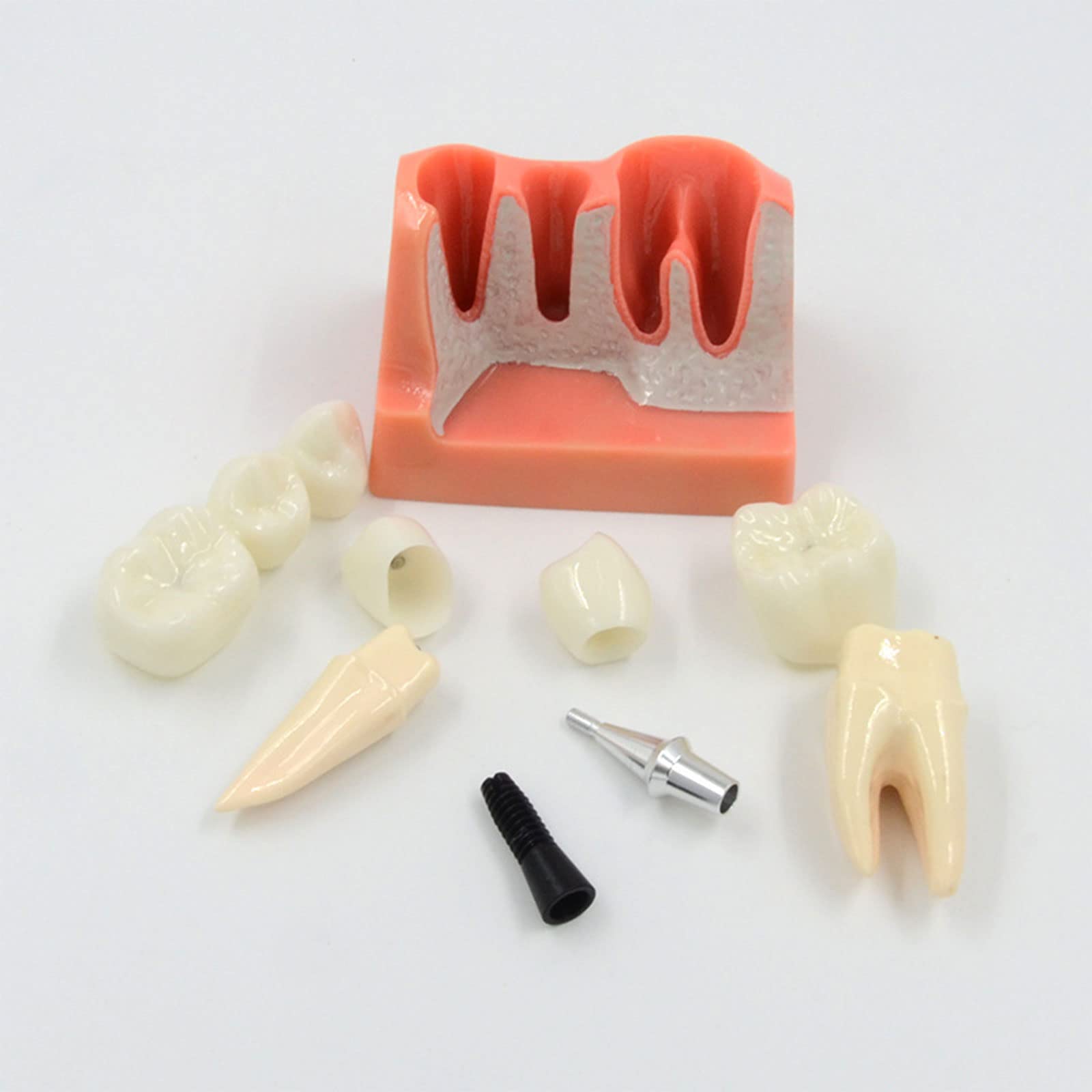 Teach Implant Analysis Bridge Removable Demonstration Teeth Model for Doctor-Patient Communication Models for Patient Education Students Teaching Research