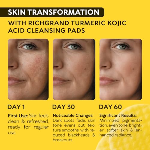 Turmeric Kojic Acid Cleansing Pads - Exfoliating Turmeric Pads for Face Dark Spots, Discoloration - Daily Skin Care for Men & Women - Natural Glow Facial Wash - Image 3