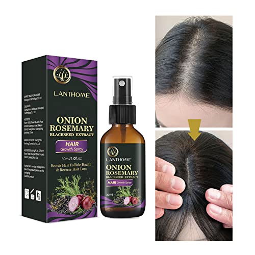 Rosemary-Essential-Oils-Rosemary-Oil-For-Hair-Growth-Onion-Rosemary-Oil-Dry-Damaged-Hair-Growth-Hair-Scalp-Oil-Rosemary-Oil-For-Hair-Growth-Spray-Supplement-Men