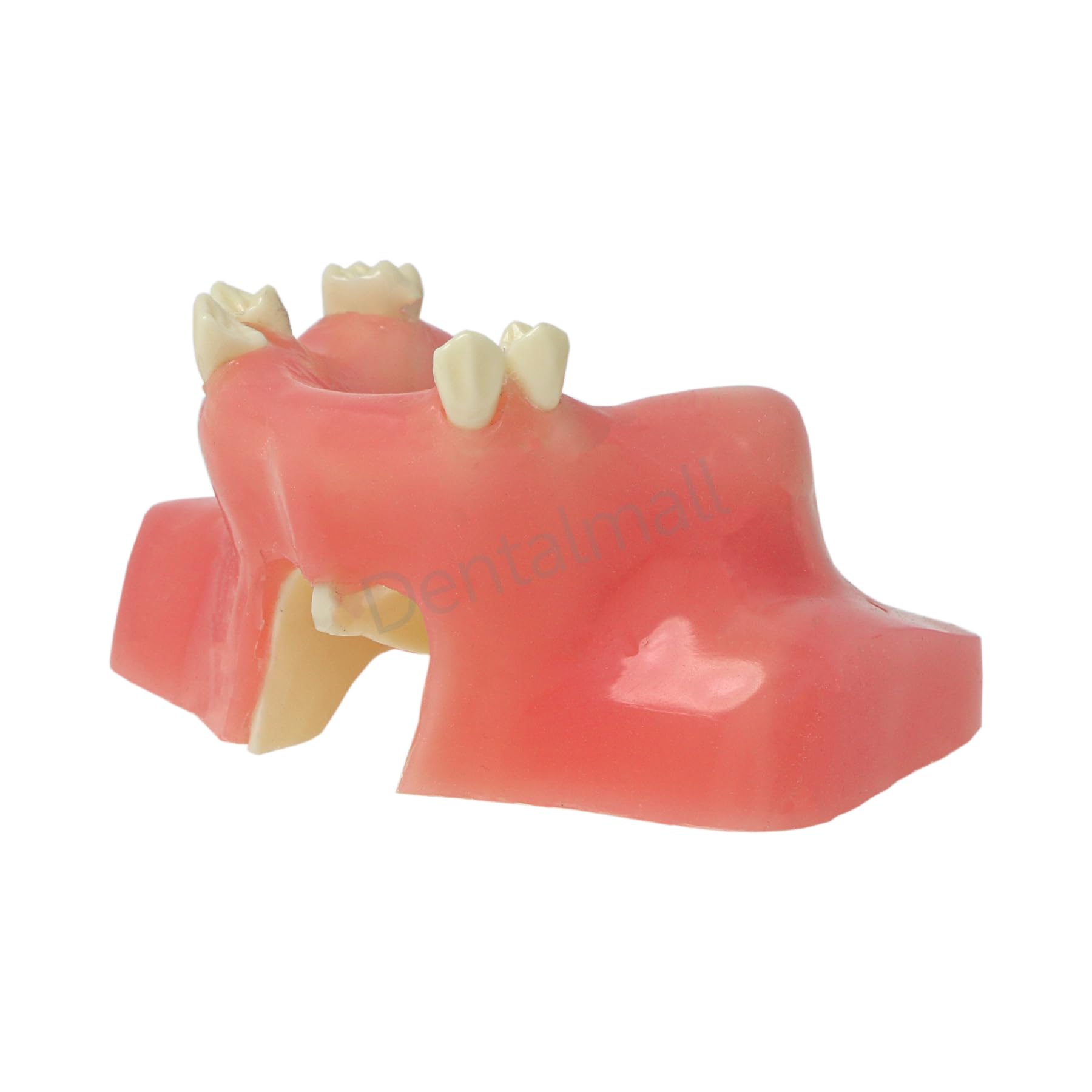 Dental Typodont Sinus Lifting Implant Placement Teeth Model Practice Upper Jaw Missing Training Incision Suturing Exercise Dentoform Prosthodontic Teaching Tool Model