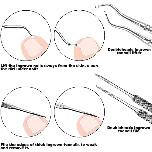 ZIZZON 7-teiliges Set mit Feilen und Hebern für eingewachsene Zehennägel, Set aus Edelstahl zum Entfernen eingewachsener Zehennägel, Nagelreiniger für die Unternagelpflege, Pediküre-Werkzeuge