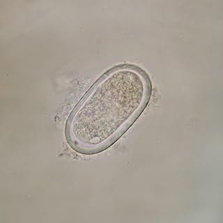Enterobius vermicularis Eggs, w.m. Microscope Slide