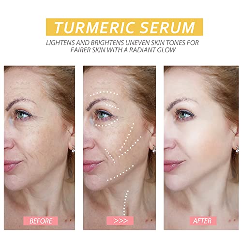 2Pcs Turmeric Serum,Turmeric Serum For Dark Spots,Turmeric Repair Face Serum,Reduces Hyperpigmentation, Age Spots, Sun Spot, Improve Skin Tone, For Women And Men #TOP1