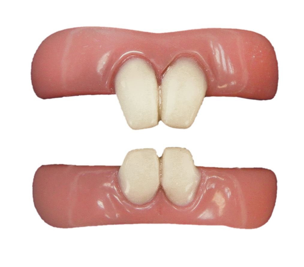 Vermin Teeth FX by Hollywood Artist Christien Tinsley – Realistic Special Effects Teeth for Halloween, Cosplay, and Movie Props – Easy Application, High Impact