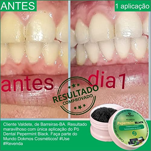 Kit Aromatizador Bucal Clareador De Dente E Pomada Refresca