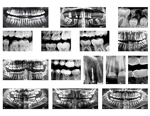 dental x-rays