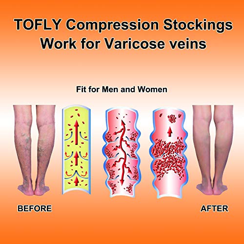 Image of TOFLY Calf Compression Sleeve for Men & Women, 1 Pair, Footless Compression Socks 20-30mmHg for Leg Support, Shin Splint, Pain Relief, Swelling, Varicose Veins, Nursing, Travel, Plus Size S - 5XL