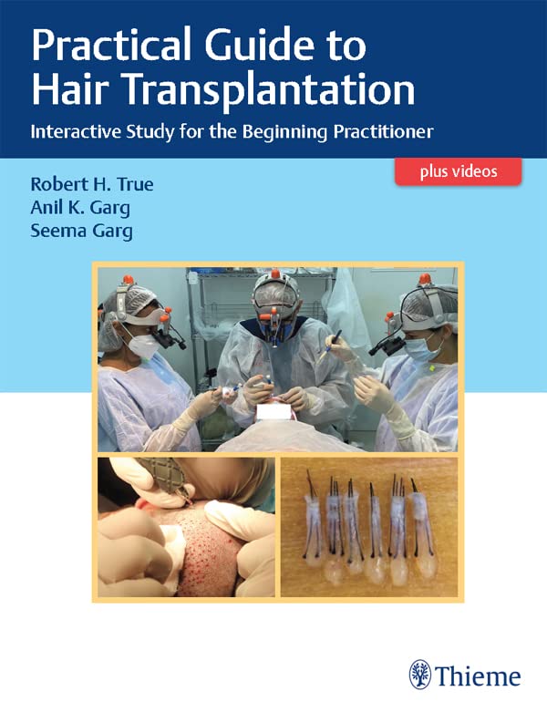 Practical Guide to Hair Transplantation: Interactive Study for the Beginning Practitioner (English Edition)