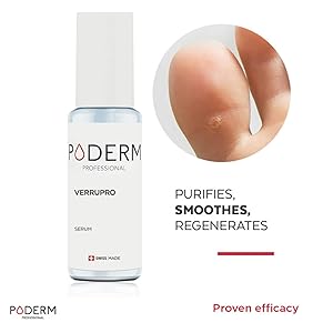 PODERM - VERRUPRO HAND & FOOT SOLUTION - ANTI-VERRUCA serum 100% natural ingredients - Professional treatment for verrucas and warts - Quick & Easy - Swiss Made PODERM - VERRUPRO HAND & FOOT SOLUTION - ANTI-VERRUCA serum 100% natural ingredients - Professional treatment for verrucas and warts - Quick & Easy - Swiss Made