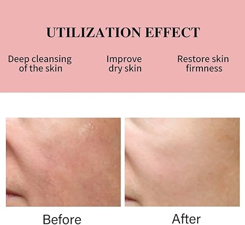 Miniatura 4 de Generic Tónico antienvejecimiento 5 en 1 Glow Niacinamide Colágeno – Spray hidratante de niebla facial con vitamina E y C, tónico facial para el