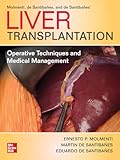 Liver Transplantation: Operative Techniques and Medical Management