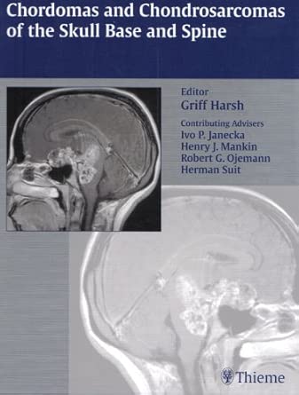 Chordomas and Chondrosarcomas of the Skull Base and Spine book cover