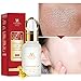 Produktbild ColorfulLaVie Hexe Haselnuss Poren Kontraktion Serum, Kontrollöl, Hydrierende Reparatur Poren Gesicht Serum 10ml