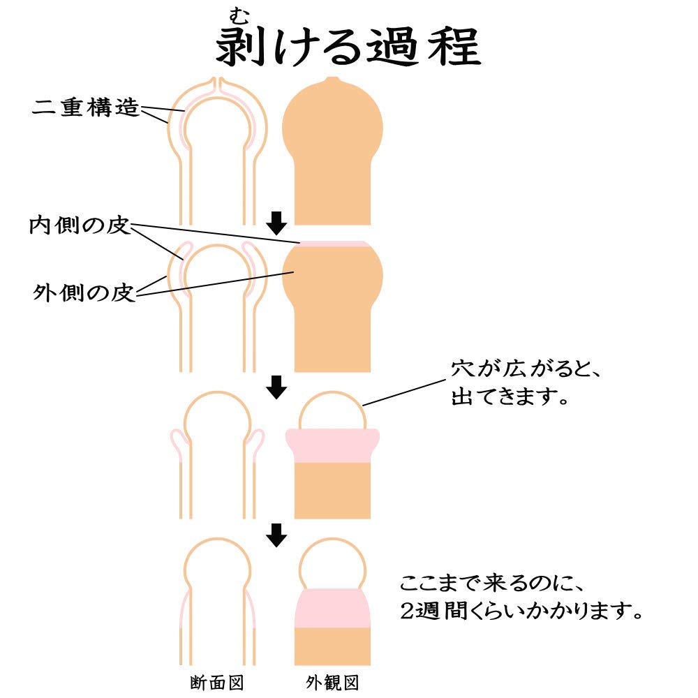 Amazon | キトー君 真性専用。仮性の方は使えません。 (DX ストッパー