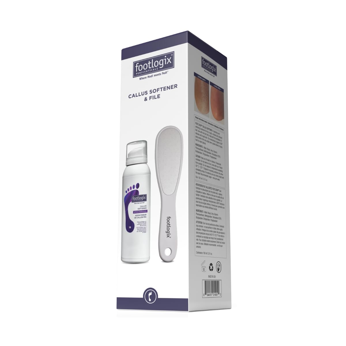 Footlogix El mejor combo para el cuidado de los pies en casa. Incluye suavizante de callos Footlogix de 125 ml y lima de pie de acero inoxidable de doble cara. Adecuado para todo tipo de piel.