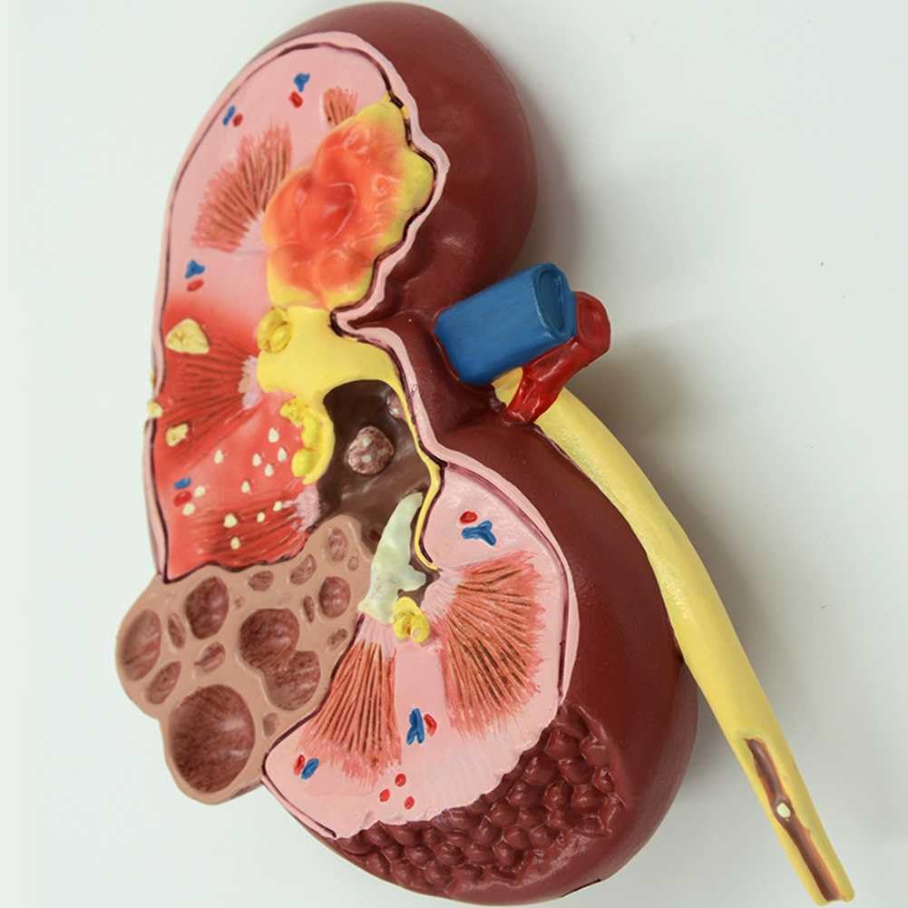 Model Nerki Z 2 Odłączanymi Częściami I 24 Cyfrowymi Etykietami Oraz Instrukcjami Anatomicznymi Dotyczącymi Ułożenia, Pozwalającymi Zrozumieć Strukturę Ludzkiej Nerki