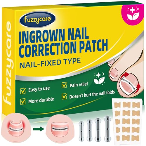 Large Size-Titanium Alloy Ingrown Toenail Treatment &...
