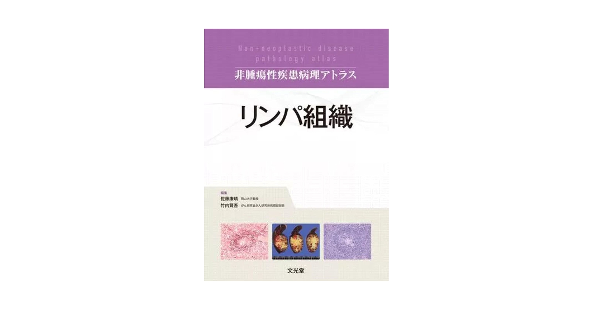 リンパ組織 (非腫瘍性疾患病理アトラス) | 佐藤康晴, 竹内賢吾