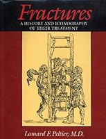 Fractures: A History and Iconography of Their Treatment (Norman orthopetic series) 0930405161 Book Cover