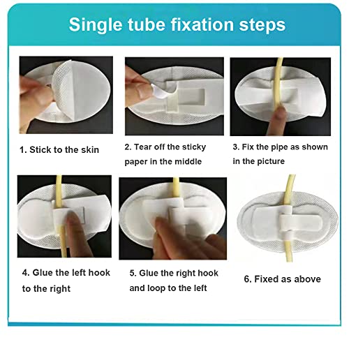 Catheter Stabilization Device Catheter Urinary Leg Bag Legband Holder Legband Holder Sticker (Pack Of 4) #TOP4