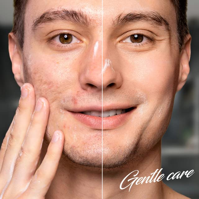 Scar Removal Cream for Women and Men - Rapid Repair of New Old Scars, Acne Spots, Burns All Natural Treatment with Vitamin E, Alanine, Collagen