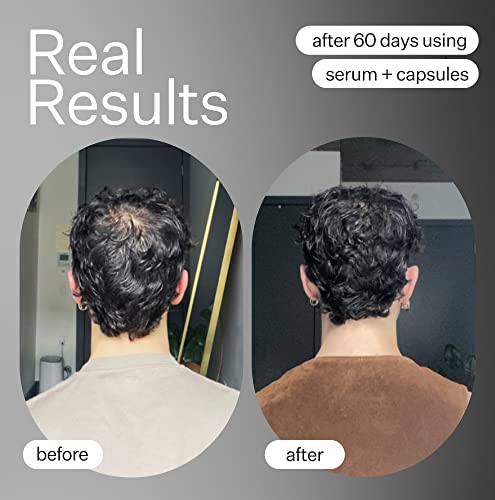Act+Acre Cold Processed Apple Stem Cell Serum - Promotes Growth And Lessens Hair Loss - Soothes And Hydrates The Scalp - Sulphate And Paraben Free - Aloe Vera For Improved Scalp Health. #TOP4