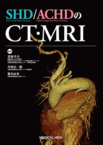 楽天 無料電子書籍 SHD/ACHDのCT・MRI バイ