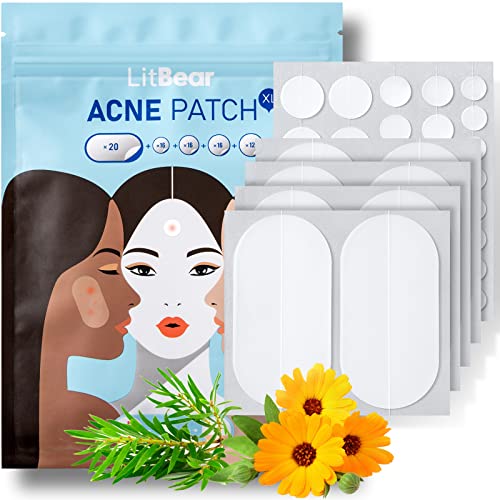 Acne Pimple Patches, 5 Sizes 80 Patches for Large Zit Breakouts, LitBear Acne Patches for Face, Chin or Body, Acne Spot Treatment with Tea Tree & Calendula Oil, Hydrocolloid Bandages for Acne Skin