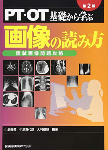 無料電子書籍 アプリ PT・OT 基礎から学ぶ 画像の読み方 第2版 国試画像問題攻略 バイ