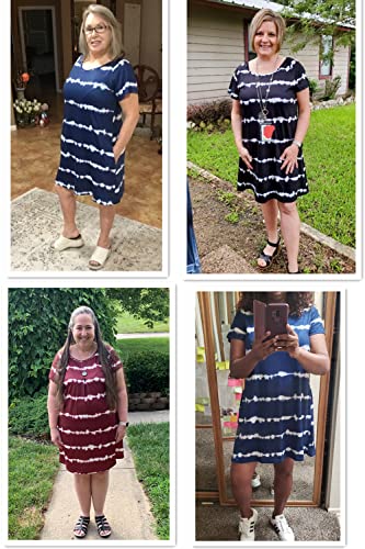 Image of Alaster Women's Casual Summer T Shirt Dress Loose Short Sleeve Tunic Dress with Pocket for Women