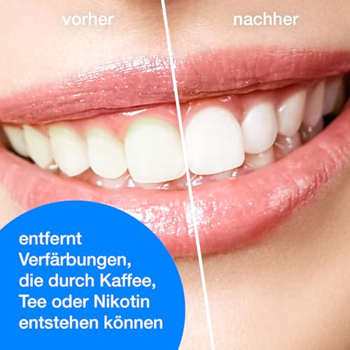 Wellsamed Sparset mit 1 Stück Stain Remover Zahnsteinentferner + 10 x 2 g Polierpaste, für eine effektive Zahnsteinentfernung – Bild 7