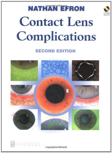 Preisvergleich Produktbild Contact Lens Complications