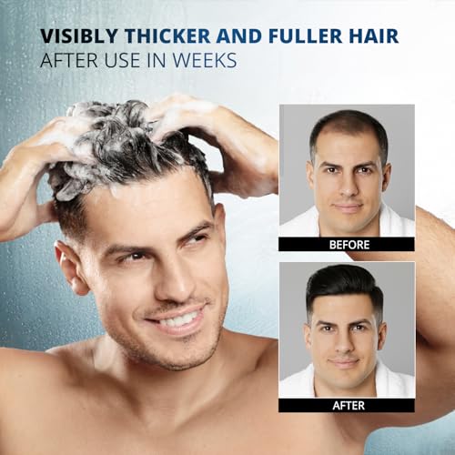 Image of Root Activator Shampoo for Men: Made In USA - Hair Growth Shampoo for Hair Loss and Thinning Hair - Hair Loss RegrowthTreatments for Women Men (Refreshing Scent)